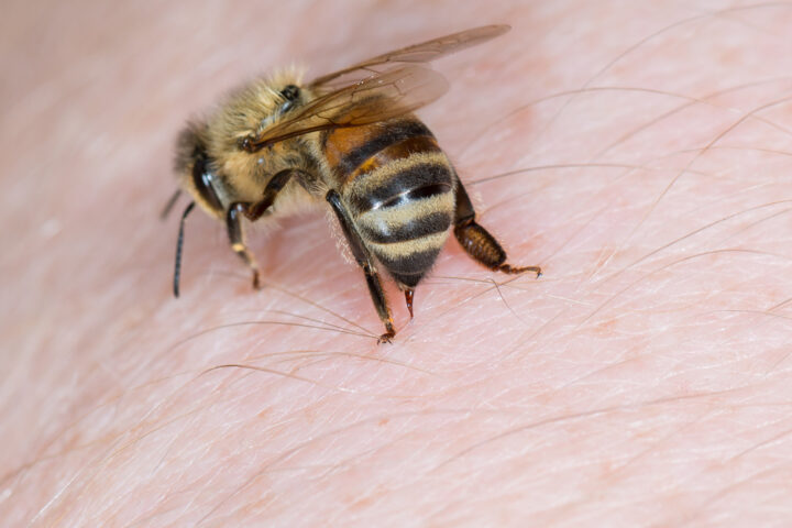 蜂に刺される夢は金運アップのサイン？状況別に蜂の夢の意味を解説